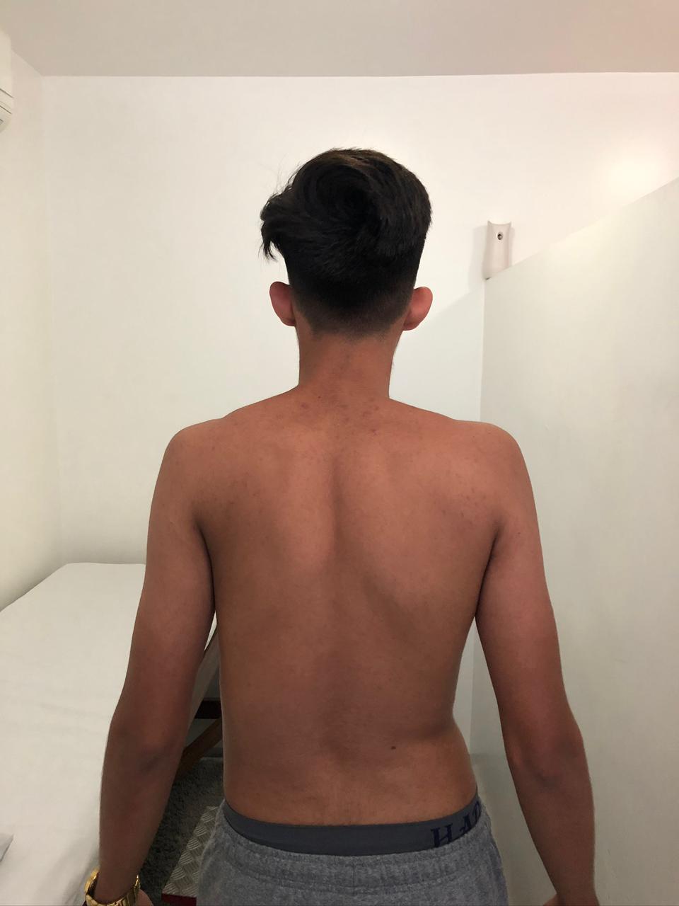 antes 1