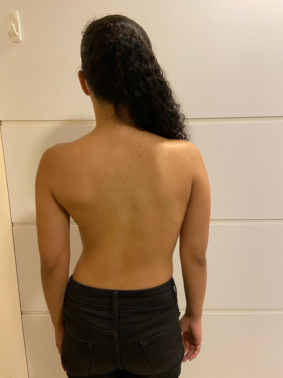 antes 2