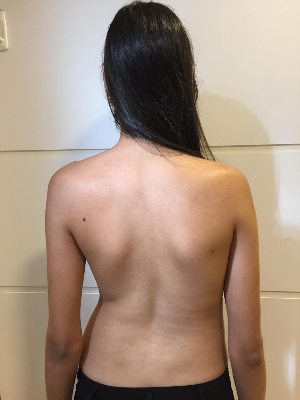 antes 6