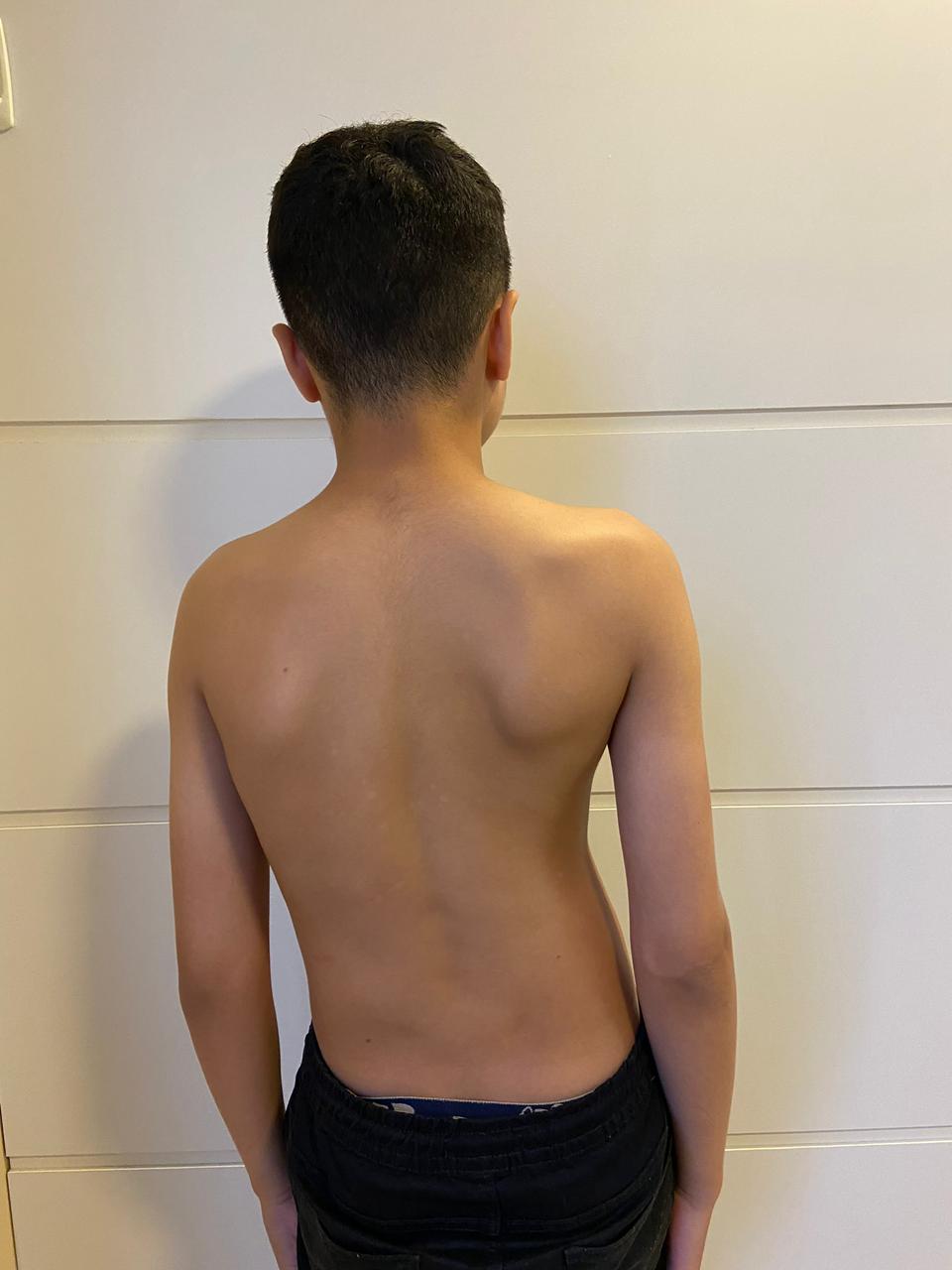 antes 7